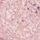 Pink Glitter