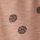 Brown Spot