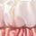 Candy Cane