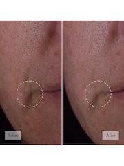 Philosophy Dose of Wisdom Bouncy Skin Reactivating Serum 30ml - Image 3 of 5