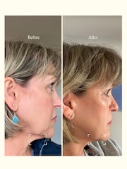 Absolute Collagen Deep Lift Neck  Dec Cream - Image 4 of 5