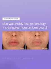 Dermalogica Stabilizing Repair Serum - Image 3 of 6
