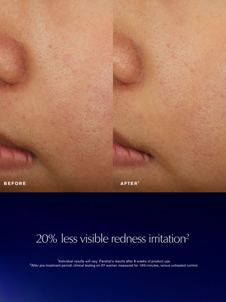 Estée Lauder Advanced Night Repair Recovery Treatment Lotion 200ml - Image 6 of 6