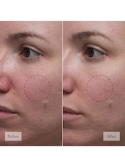 Philosophy Microdelivery Resurfacing Solution 150ml - Image 4 of 6
