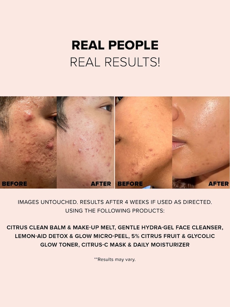 NUDESTIX Nudeskin Gentle Hydragel Face Cleanser 70ml - Image 2 of 5 NUDESTIX Nudeskin Gentle Hydragel Face Cleanser 70ml - Image 2 of 5