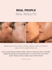 NUDESTIX Citrus Clean Balm Makeup Melt 60ml - Image 3 of 5