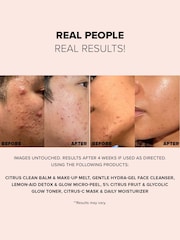 NUDESTIX Nudeskin Lemonaid Detox Glow Micropeel Face Mask 60ml - Image 3 of 5
