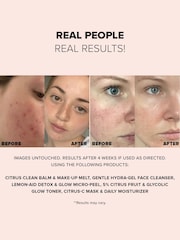 NUDESTIX Nudeskin Lemonaid Detox Glow Micropeel Face Mask 60ml - Image 4 of 5