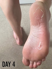 BARBER PRO Foot Peel Bootie - Image 5 of 6