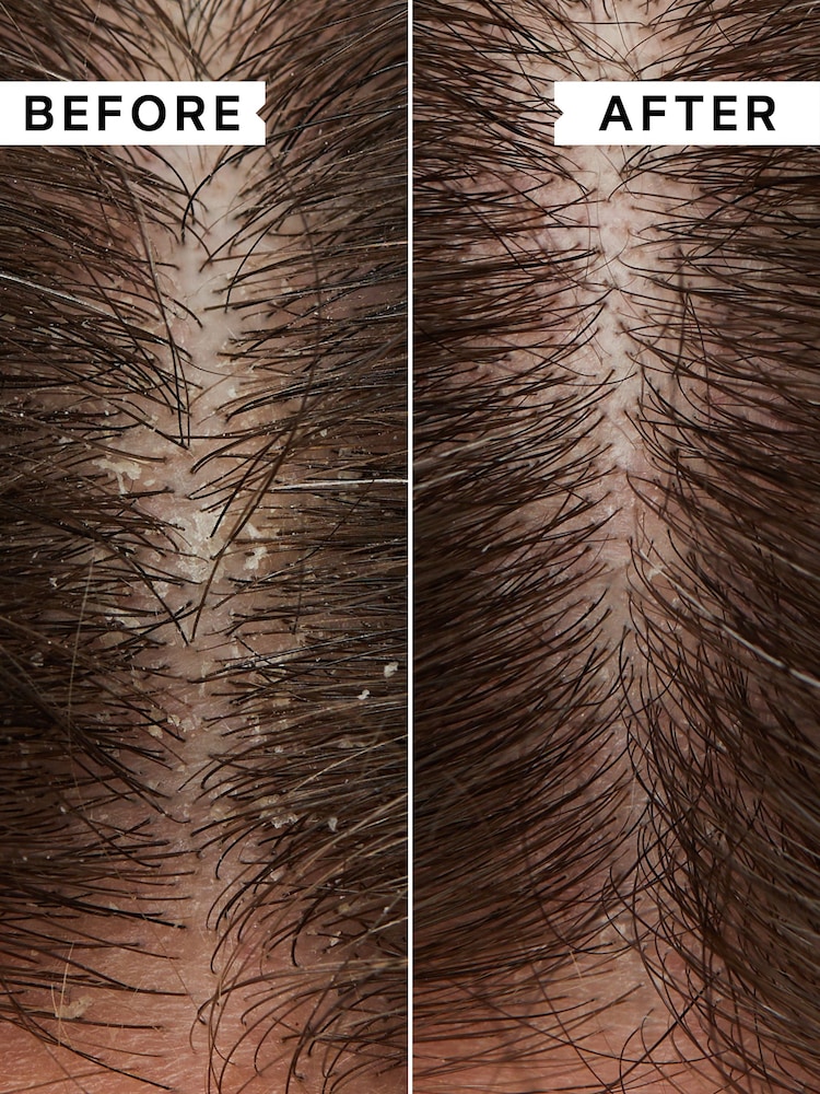 Philip Kingsley Flaky/Itchy Anti-Dandruff Scalp Toner 75ml - Image 2 of 5