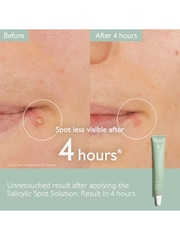 Caudalie Vinopure Salicylic Spot Solution - 15 mL - Image 2 of 5