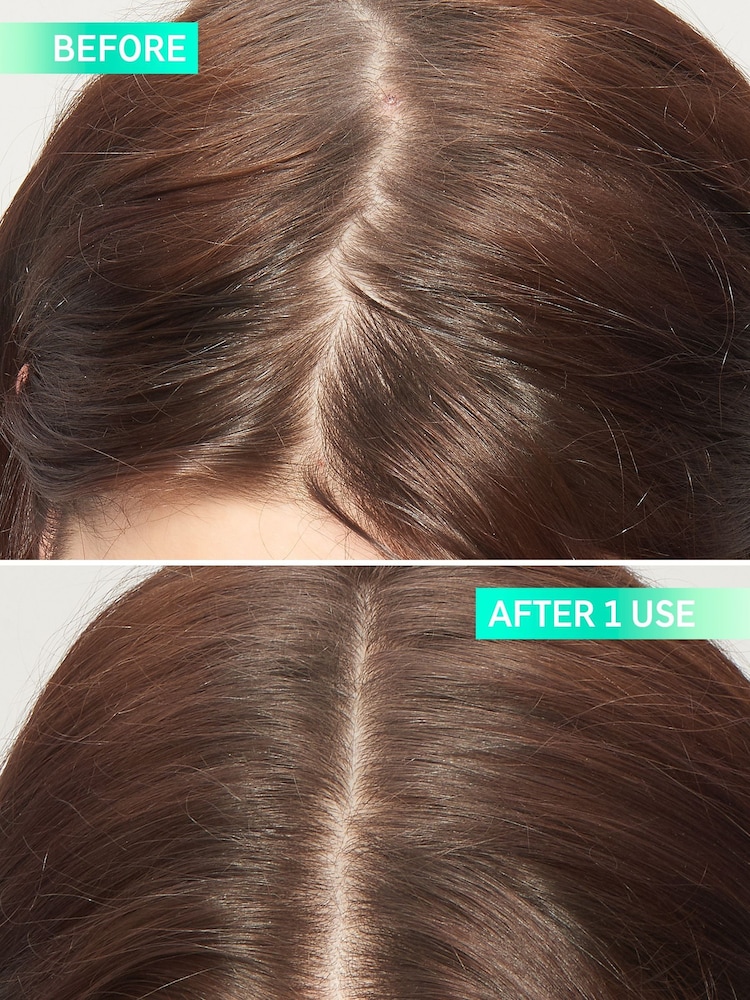 The INKEY List Glycolic Acid Exfoliating Scalp Scrub150ml - Image 2 of 4