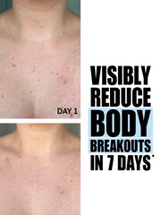 The INKEY List Glycolic Acid Exfoliating Body Stick 45g - Image 3 of 4