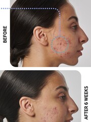 The INKEY List Super Solutions 1% Retinol Serum 30ml - Image 2 of 5