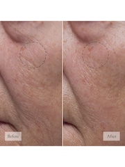 Philosophy Hope In A Jar Hyaluronic Glow Moisturiser 15ml - Image 3 of 5