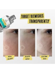 Kiehls Truly Targeted Blemish Clearing Solution Moisturiser 15ml - Image 3 of 5