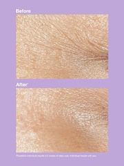 Clinique Smart Repair™ Wrinkle Correcting Rich Cream 50ml - Image 3 of 5