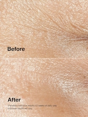 Clinique Smart Repair™ Wrinkle Correcting Cream 50ml - Image 3 of 5