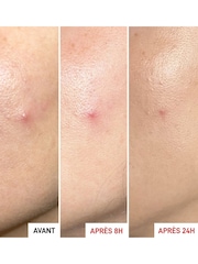 Erborian Centella SOS Patch Moisturiser - Image 3 of 4