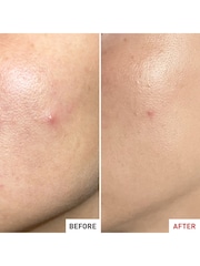 Erborian Centella SOS Patch Moisturiser - Image 4 of 4