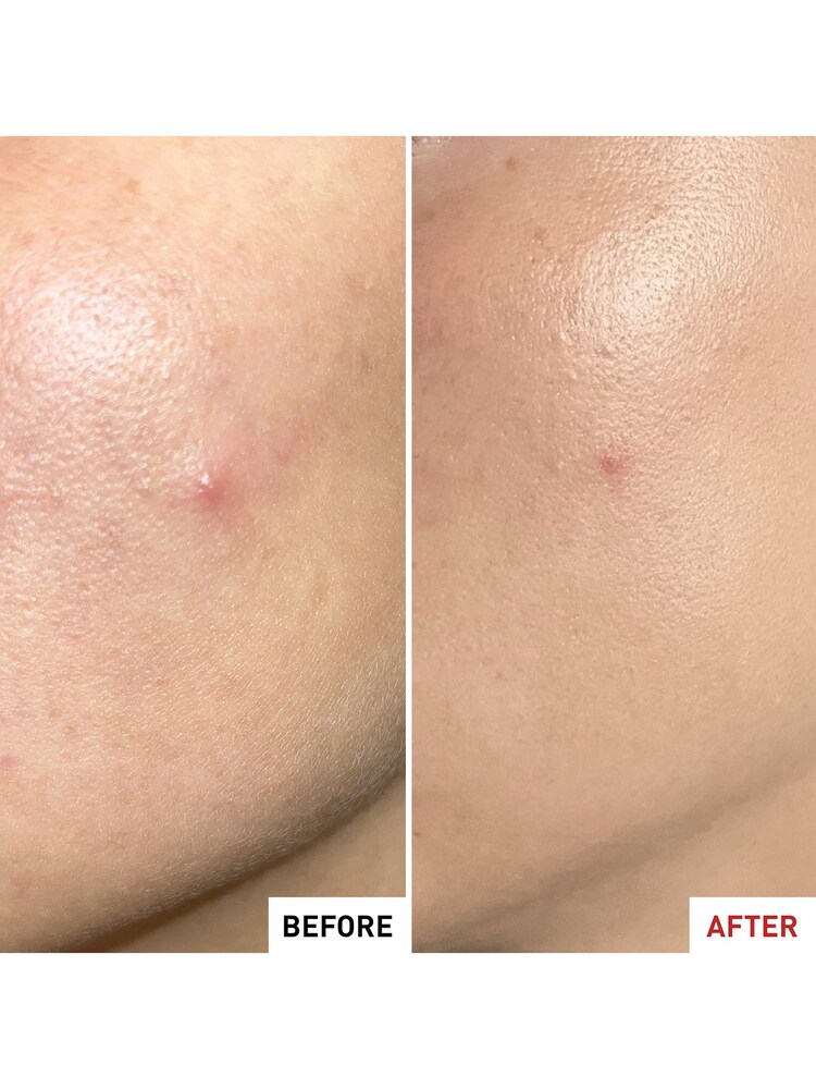Erborian Centella SOS Patch Moisturiser - Image 4 of 4