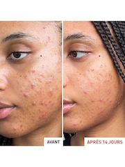 Erborian Centella Acne Care Cream - Image 4 of 4
