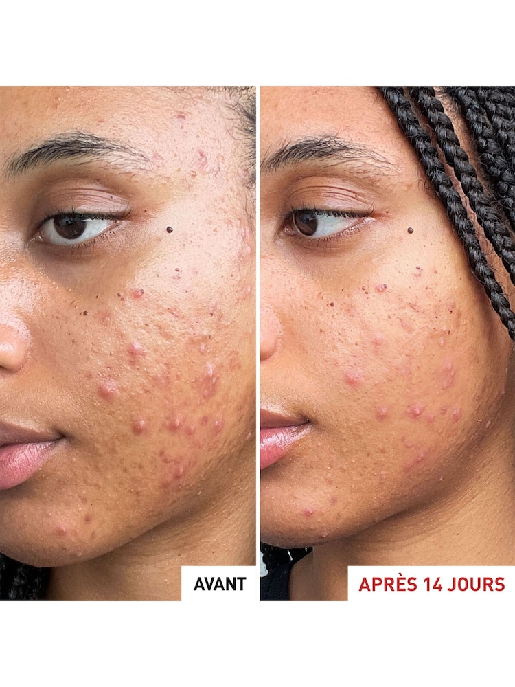 Erborian Centella Acne Care Cream - Image 4 of 4