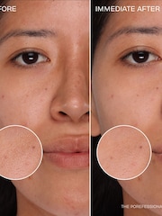Benefit The Clear Necessities Pore Care Trial Set (Worth Over £49) - Image 5 of 6