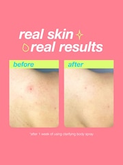 Dermalogica Clarifying Body Spray 177ml - Image 3 of 5