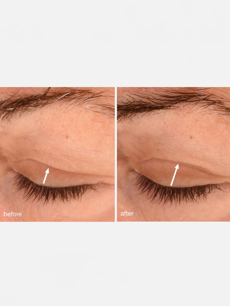 Dermalogica Phyto Nature Lifting Eye Cream 15ml - Image 5 of 5