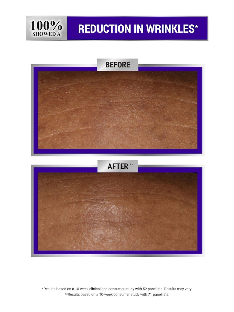 Kiehls Retinol Fast Release Wrinkle Reducing Night Serum 28ml - Image 2 of 5 Kiehls Retinol Fast Release Wrinkle Reducing Night Serum 28ml - Image 2 of 5