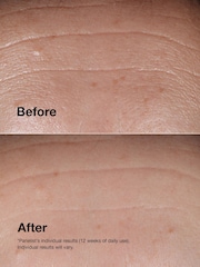 Clinique Smart Clinical Repair™ Wrinkle Correcting Serum 50ml - Image 4 of 5