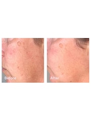 Murad Correct & Protect Broad Spectrum Sun Cream SPF45 30ml - Image 2 of 5