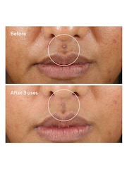 Murad Rapid Relief Sulfur Mask 75ml - Image 4 of 5