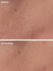 Murad Targeted Pore Corrector 15ml - Image 2 of 5