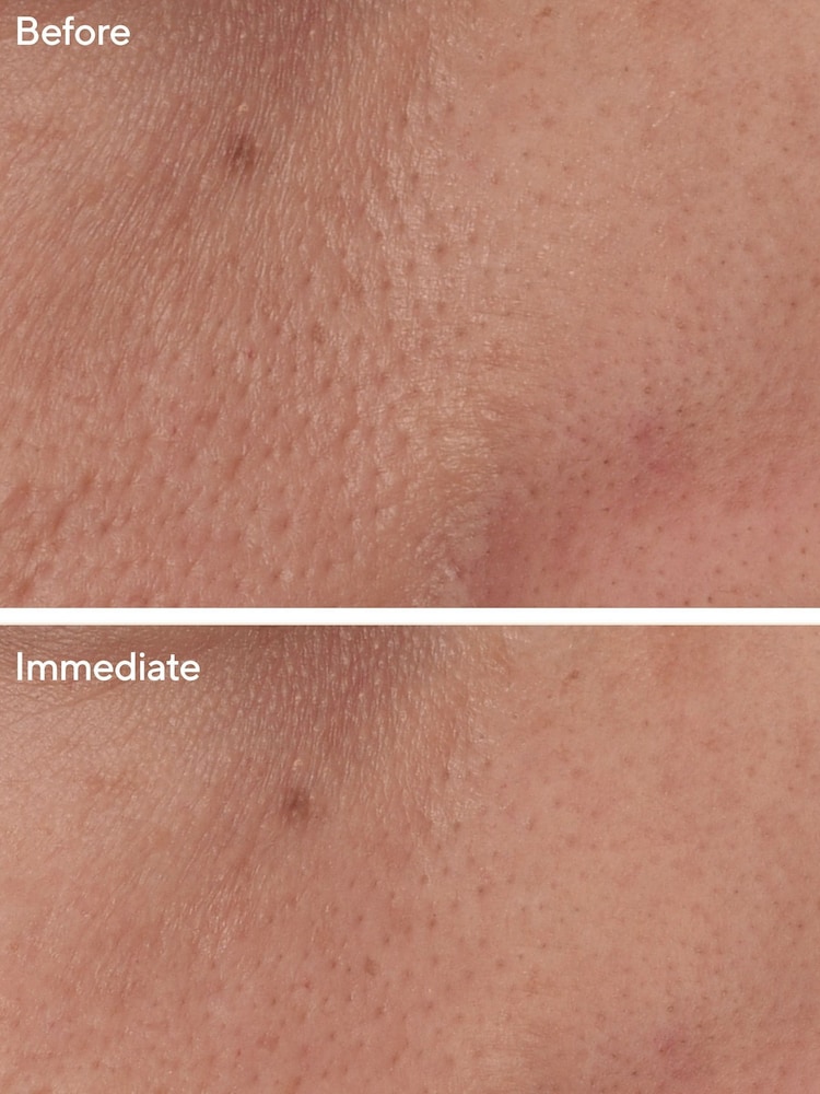 Murad Targeted Pore Corrector 15ml - Image 2 of 5