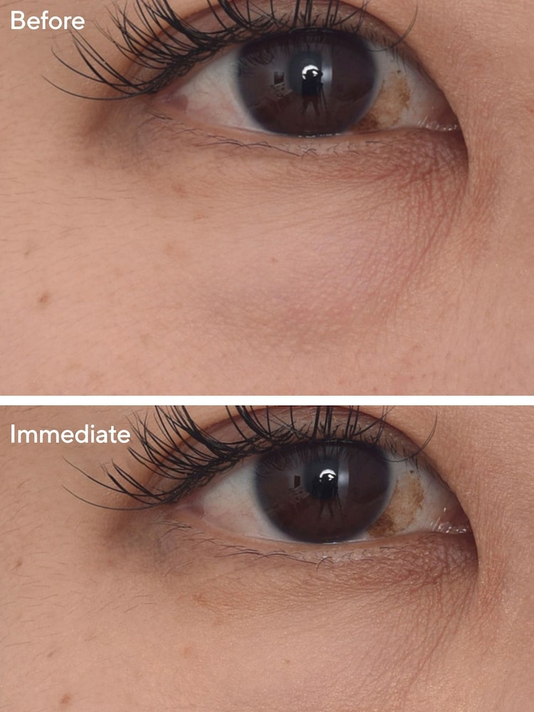 Murad Targeted Eye Depuffer 15ml - Image 2 of 5