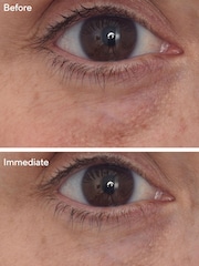 Murad Targeted Eye Depuffer 15ml - Image 3 of 5