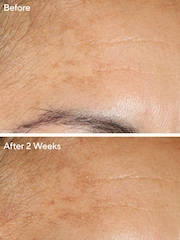 Murad Vita-C Glycolic Brightening Serum 30ml - Image 2 of 8