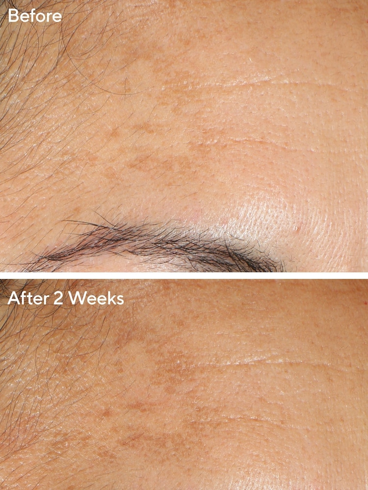 Murad Vita-C Glycolic Brightening Serum 30ml - Image 2 of 8