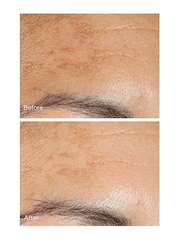 Murad Vita-C Glycolic Brightening Serum 30ml - Image 6 of 8