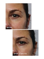 Murad Rapid Collagen Infusion Serum 30ml - Image 2 of 2