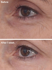 Murad Retinal ReSculpt™ Eye Treatment - Image 3 of 5