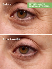 Murad Retinol Youth Renewal Eye Serum 15ml - Image 4 of 7