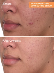 Murad Rapid Dark Spot Correcting Serum 30ml - Image 4 of 6