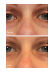 Murad Vita-C Eyes Dark Circle Corrector Serum 15ml - Image 3 of 5