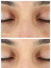 Murad Vita-C Eyes Dark Circle Corrector Serum 15ml - Image 4 of 5