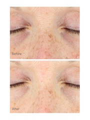 Murad Vita-C Eyes Dark Circle Corrector Serum 15ml - Image 5 of 5