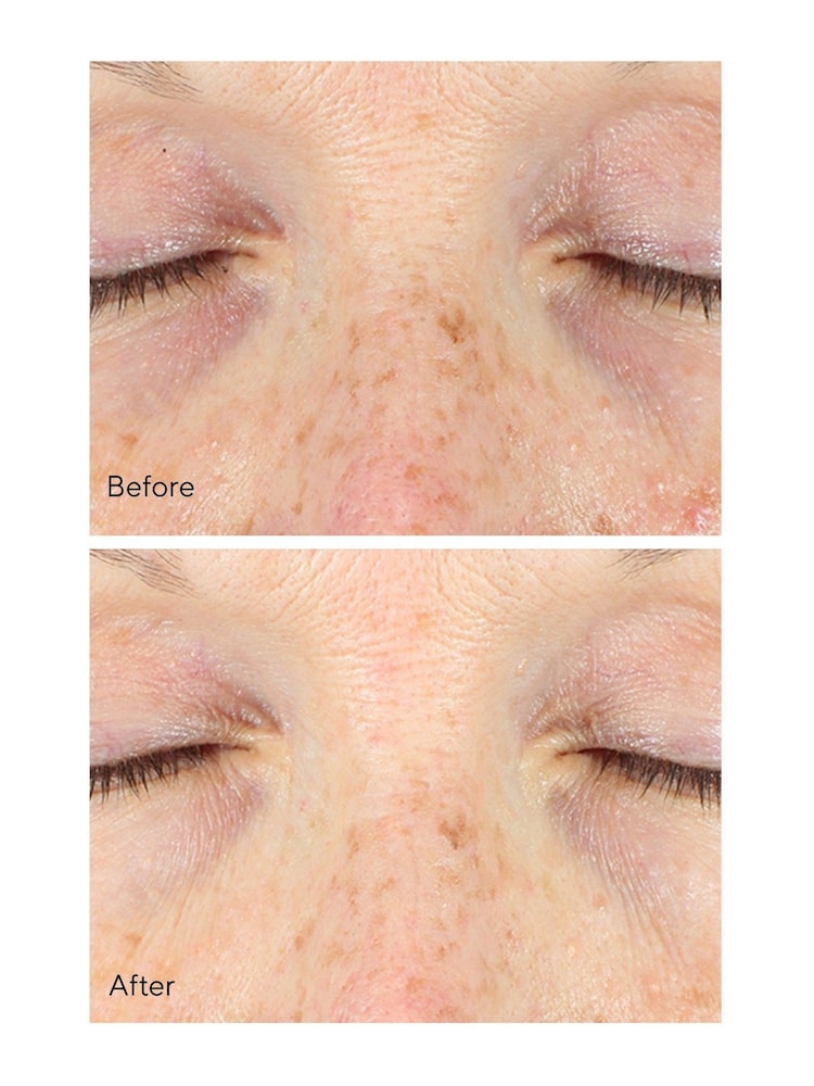 Murad Vita-C Eyes Dark Circle Corrector Serum 15ml - Image 5 of 5 Murad Vita-C Eyes Dark Circle Corrector Serum 15ml - Image 5 of 5