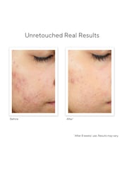 Murad InvisiScar Recovery Treatment 15ml - Image 2 of 5